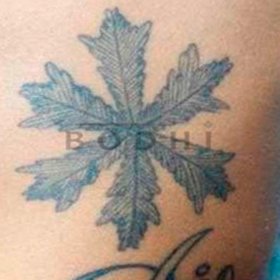 Eliminacion de tatuajes en Alicante