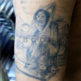Eliminacion de tatuajes en Alicante