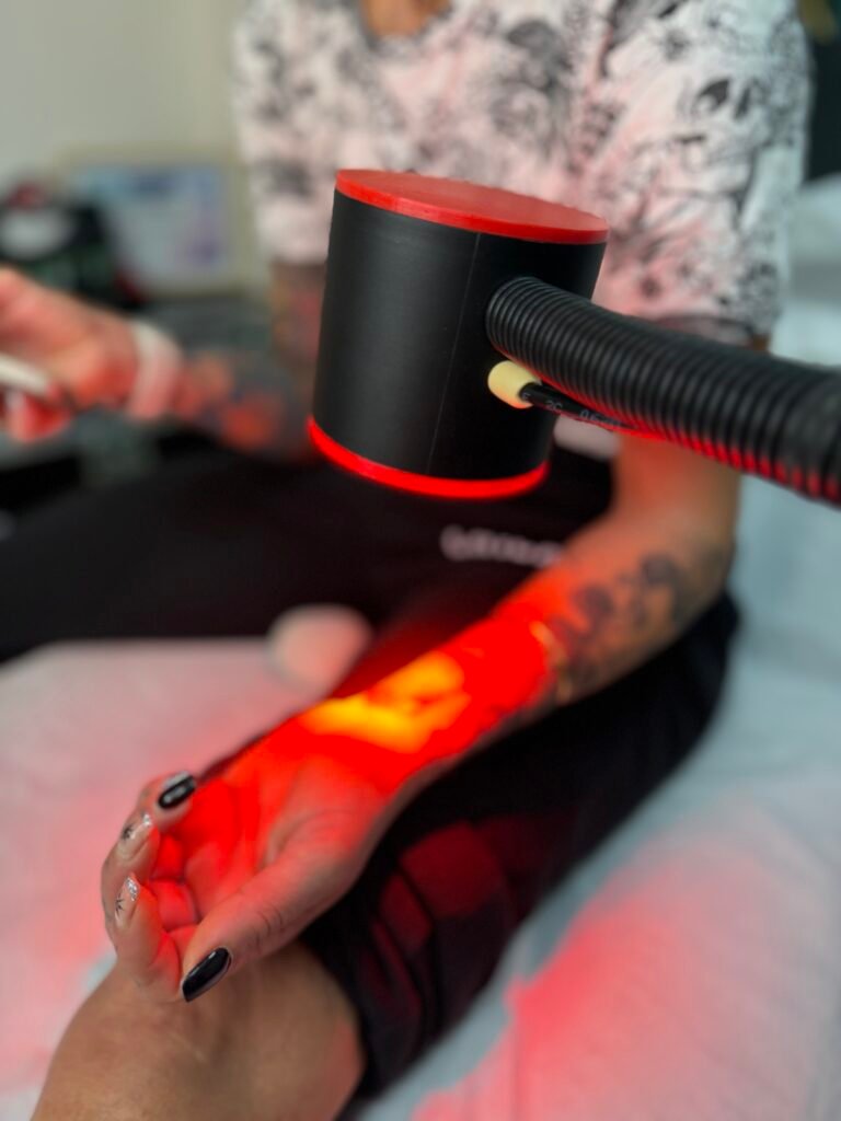 Eliminación de tatuajes en Alicante