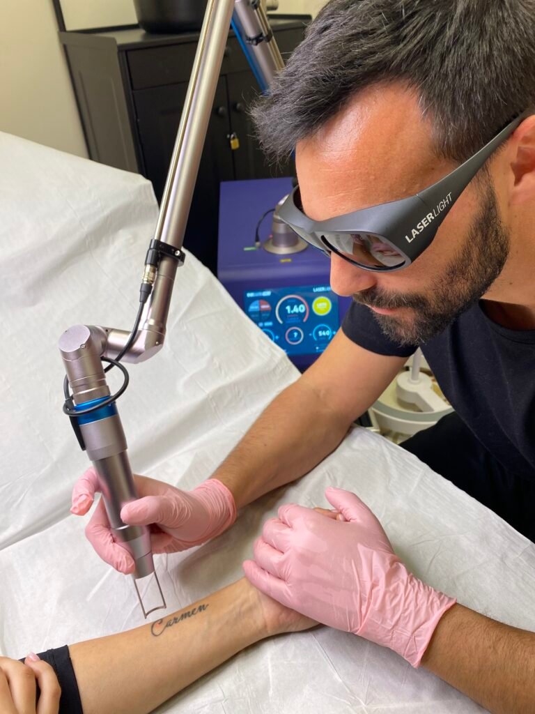 Eliminacion de tatuajes