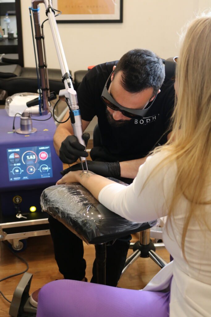 Eliminación de tatuajes con láser vs. cover-up