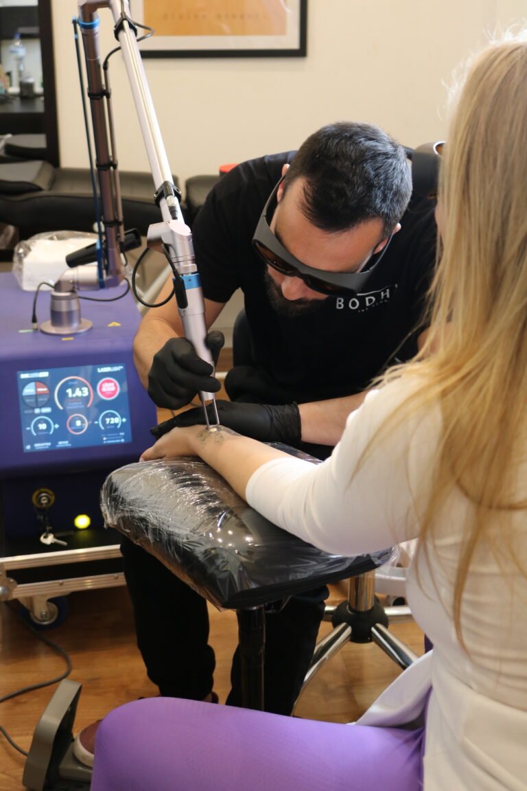 Eliminación de tatuajes con láser vs. cover-up