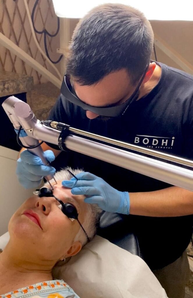 Eliminacion de microblading en Alicante